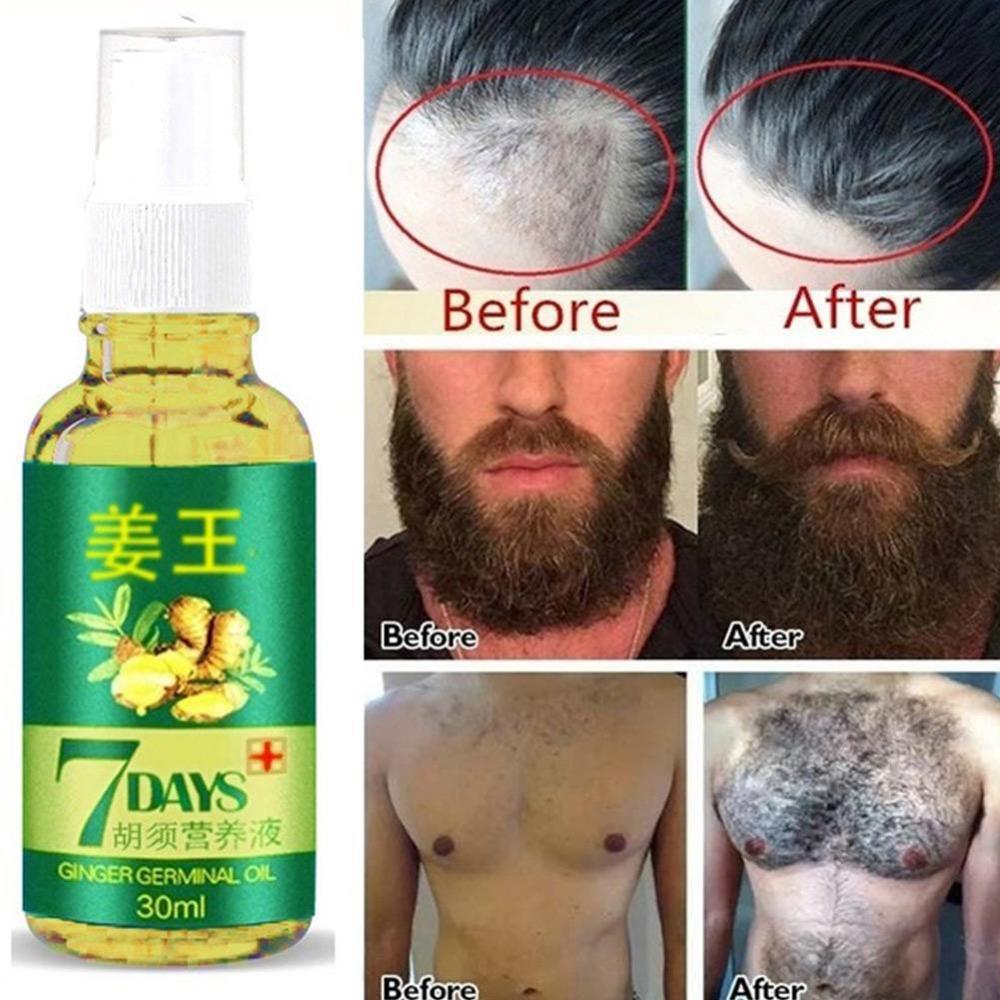 209Hot Sales Unisex Anti Hair Loss Treatment Serum Hair Ginger Hair Oil Women Regrowth Growing Extract Beard Care Men Organ S9K9