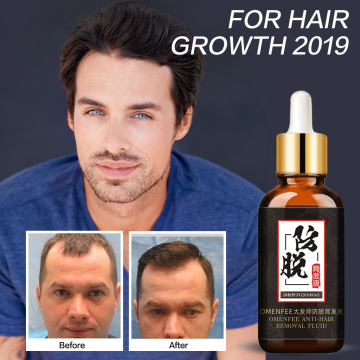 Hair Loss Products and Fast Hair Growth Remedy Essence Oil Natural Extracts Liquid Hair Regrowth Products Treatment Solutions