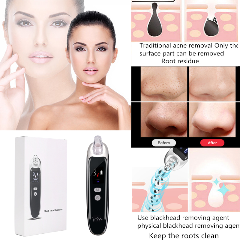 Blackhead Acne Remover Electric Black Spots Pore Cleaner Acne Remover Acne Tool Suction Facial Nose Blackhead Acne Cleaner