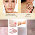 1/2PCS 7g Sulfur Soap Skin Conditions Acne Psoriasis Seborrhea Eczema Anti Fungus Bath Whitening Soap Shampoo dropship TSLM1