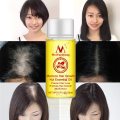 Natural Hair Loss Treatment Andrea Hair Growth Products Ginger Oil Hair Growth Faster Grow Hair Ginger Shampoo Stop