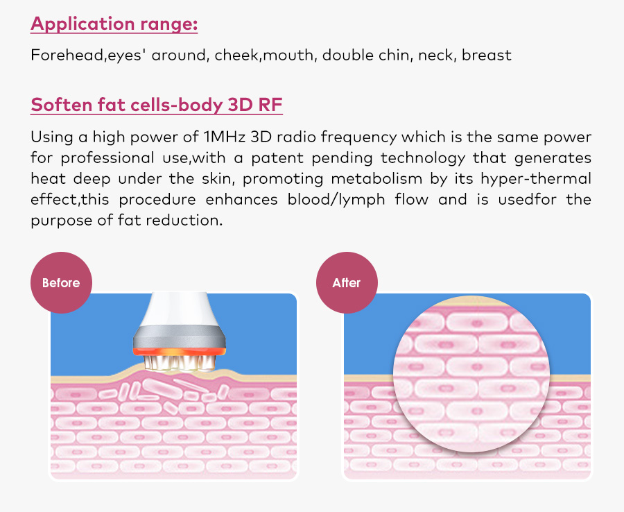 Omeina rf and cavitation machine