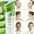 Natural Aloe Vera Gel Cream Moisturizing Anti-Wrinkle Cream Acne Scars Whitening Skin Sunscreen Acne Treatment Skin Care