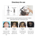 LANBENA Ginger Hair Growth Essential Oil Anti-hair Loss Nourish Hair Roots Consolidate Hair Loss Serum Hair Regeneration Product