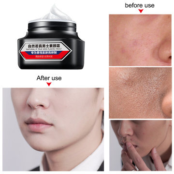 Man Skin Whitening Face Cream 50ml Concealer Ointment Cream Moisturizing Cream Fine Lines Acne Treatment Skin Care Hot Sale