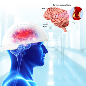 Medical 1-20000Hz adjustable light therapy helmet for Alzheimer