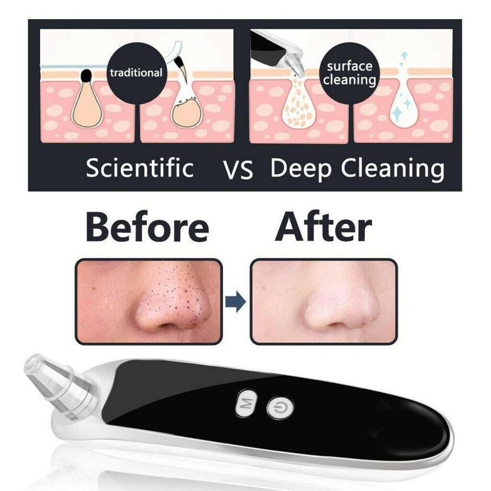 Electric Acne Blackhead Remover Vacuum Suction Face Pimple Extractor Tool Black Spots Facial Pores Cleaner black head remover