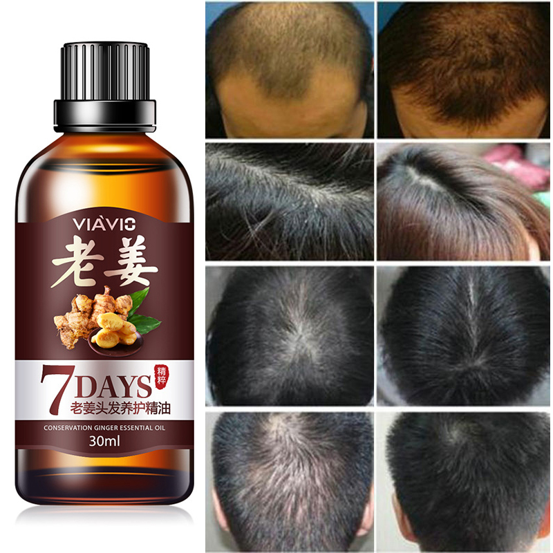 30ml Hair Loss Treatment Fast Hair Growth Dense Regrowth Ginger Serum Oil Effective Repair Damaged Hair Nourish Hair TSLM2