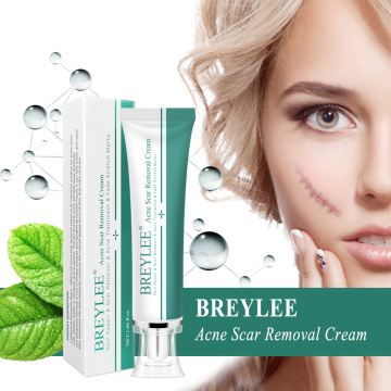 BREYLEE Scar Gel Cream Bruises Stretch Treatment 30g Skin Care Old & New Scars Acne Cream Marks Treatment