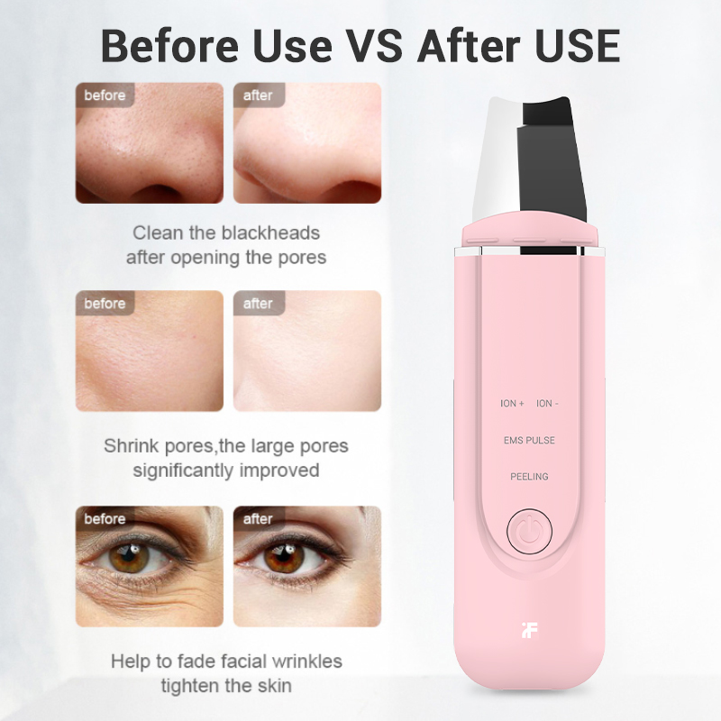 Inface Peeling Shovel Ultrasonic Face Cleaning Skin Scrubber Wrinkles Reduce Blackhead Removal Pore Cleaner Tools Care