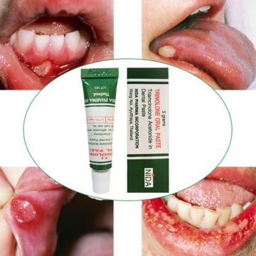 Thailand Herb Oral ulcers Cream oral inflammation toothache tongue Pain Ointment Dental care Treatment Cream Plaster