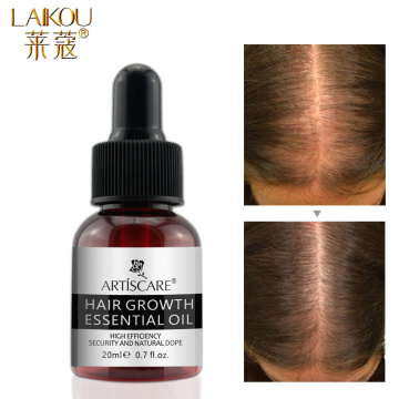 LAIKOU Hair Care Hairs Growth Essential Oil Scalp Treatments Nutrition Repair Dry and Damaged Fast Hair Nutrition Essential Oils