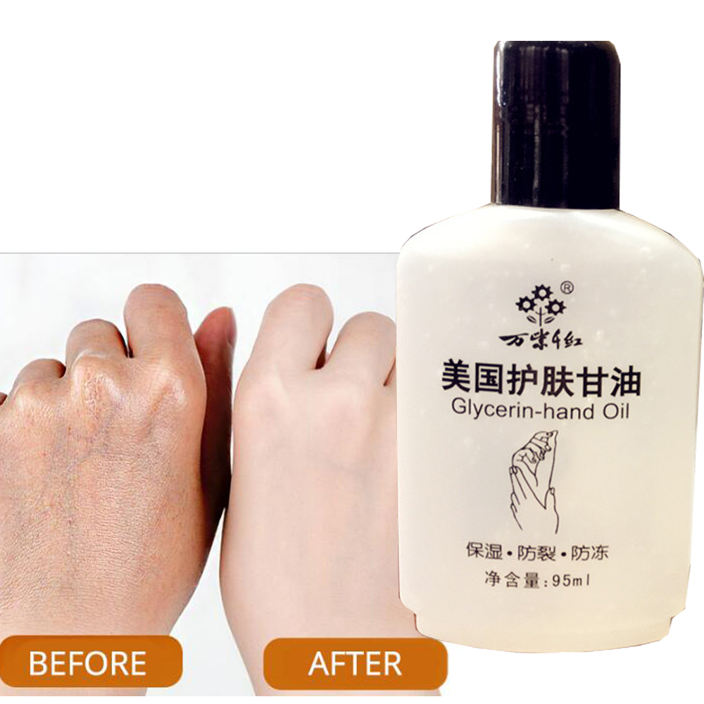 American Glycerol Moisturizing Body Care Hand Foot Whitening Hydration Soothing Body Lotion Face Toner Skin Care Sunscreen Oil