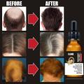 Hair Growth Essential Oils Ginger Germinal Oil Fast Anti-Hair Loss Dense Alopecia Hair Hair Serum Beauty Growth Treatment G D9C6