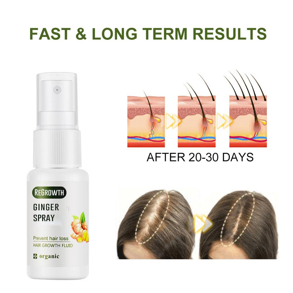 Regrowth Ginger Spray Fast Hair Growth Fluid Anti Loss Treatment Ginger Essence Prevent Hair Loss Regrowth Ginger Spray 30g
