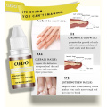 High Quality 10ml Nail Fungus Treatment for Onychomycosis Removal Antifungal Nail Care Repair Solution
