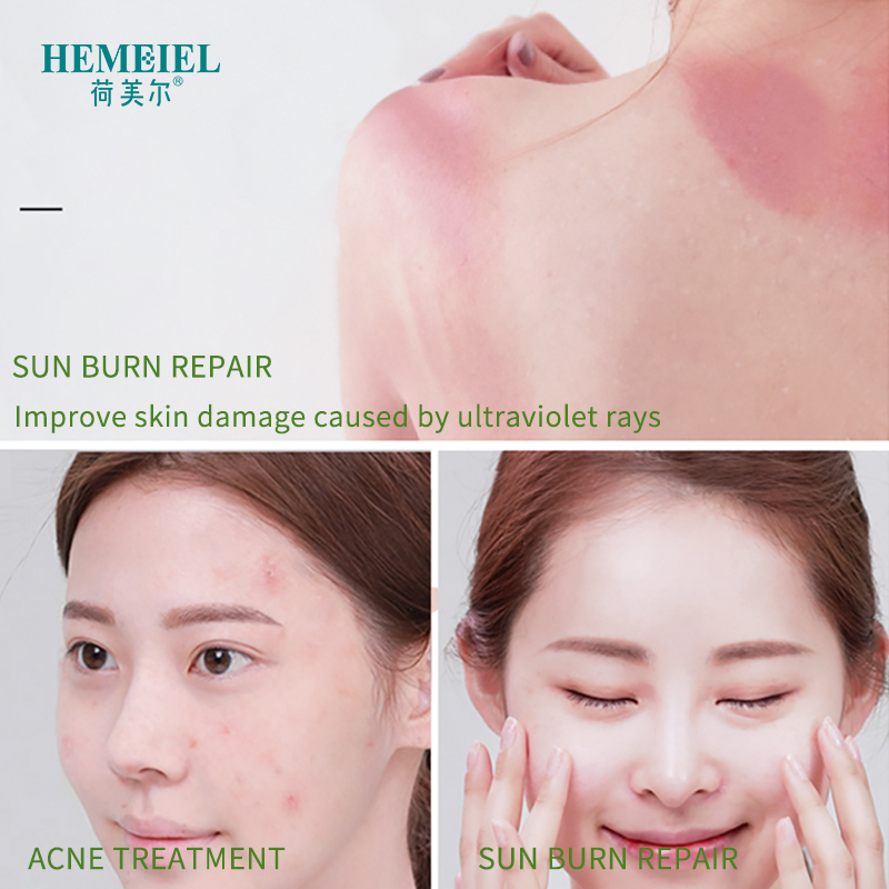 HEMEIEL Aloe Vera Gel Pure Natural 100% Face Cream Moisturizer Soothing Gel Acne Treatment Scar Remove Sunburn Repair Aloe Cream
