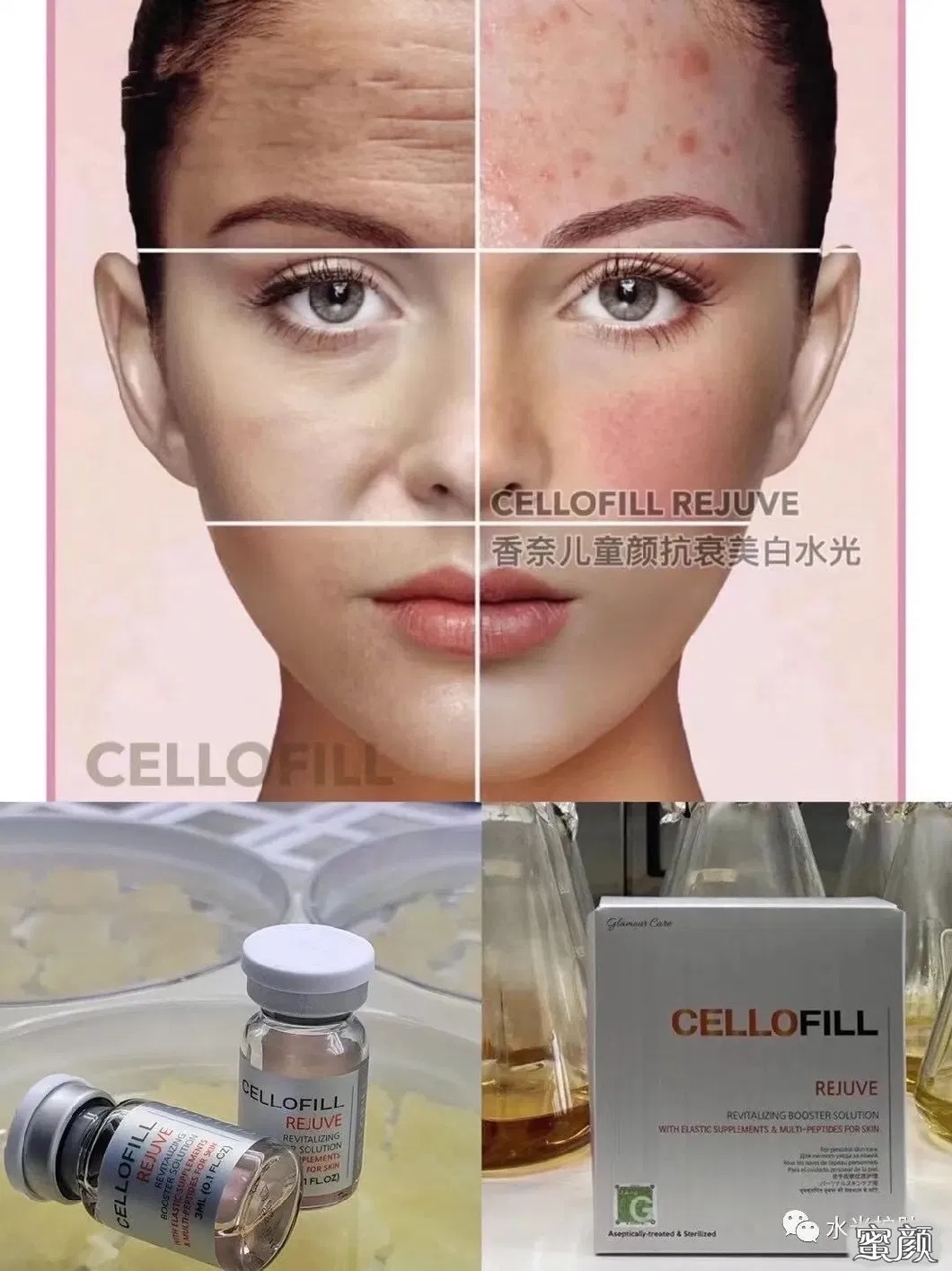2022-New-Top-Selling-Korea-Origin-Chanel-Cellofill-Rejuve-for-Skin-Face-Reguventing-Anti-Aging-3ml-6vials-Skin-Booster-Dermal-Filler-Injection.webp (4)