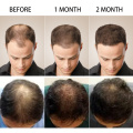 Effective Anti Hair Loss Hair Growth Serum Hair Fast Growing Natural Ginger Oil Hair Care Hair Loss Product