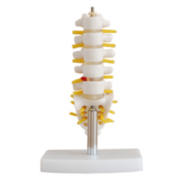 Model of small lumbar vertebrae with caudal spine