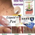 5ML Skin Care Plantar Wart Remover Corn Callus Remover Removal Liquid Pen Stops Regrowth