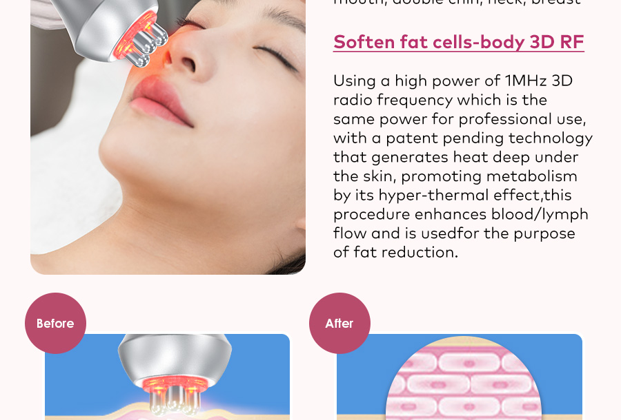 rf body contouring