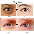 Retionl Eye Serum Age-defying Moisturizing Whitening Eyes Cream Fade Dark Circles Wrinkle Fine lines Bags Essence Eye Care TSLM2