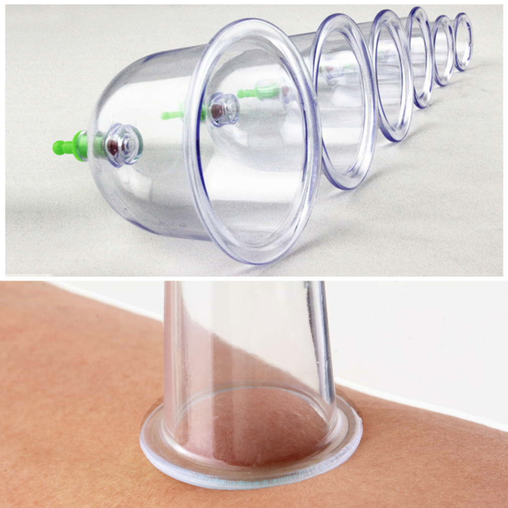 6pcs/set Medical Vacuum Body Cupping Therapy Cups Massage Skin Care Tool