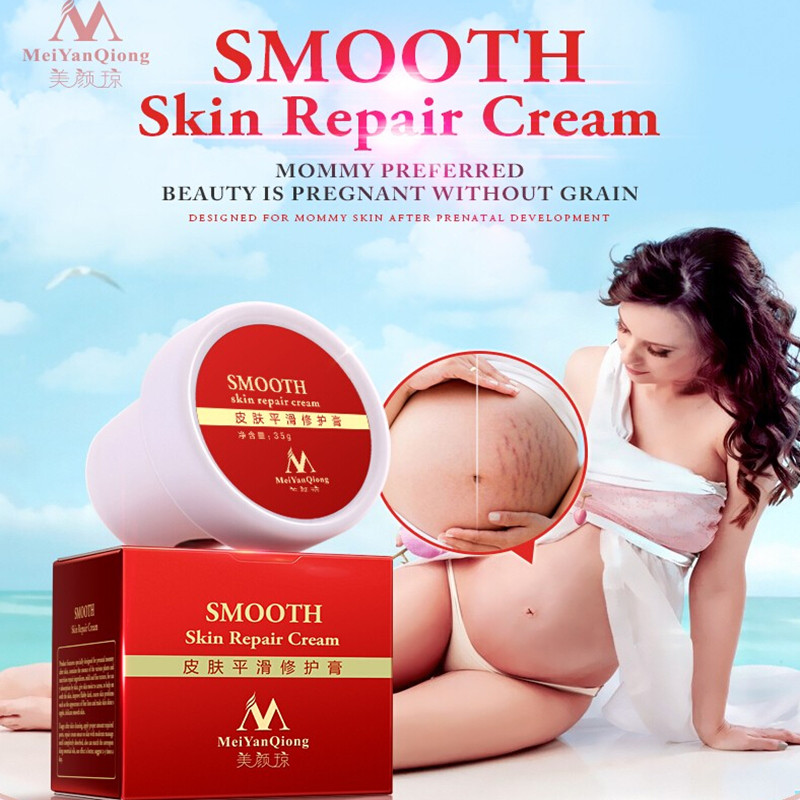 High Quality Smooth Skin Cream For Stretch Marks Scar Removal To Maternity Skin Repair Body Cream Remove Scar Care Postpartum