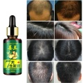 7 Day Ginger Germinal Serum Essence Oil Loss Treatement Growth Hair 30ML Healthy Hair Growth Essence Oil TSLM1