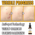 10-30mL Skin Tag Remover Essential Oil Fast Removal Mole Wart Foot Corn Treatment Anti Wart Organic Face Cream TSLM1