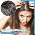60g Essence Scalp Shampoo Bar Glossy Cleansing Hair Darkening Unisex Adults Anti Dandruff Handmade Regrowth Home Health Care