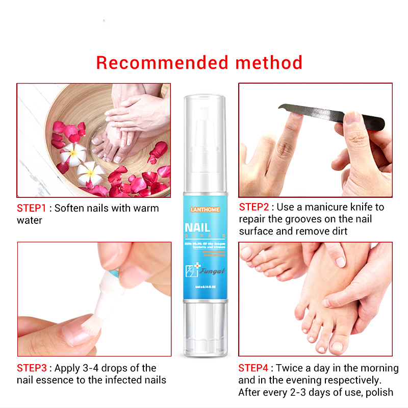 Fungal Nail Treatment Pen Fungal Nail Repair Remover Cuticle Oil Pen The Herb Bright Cream Disinfection Toe Nail Fungus Remover