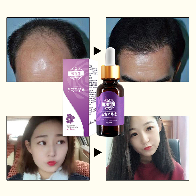 5 pcs Hair Loss Product Hair Growth Essential Oil Faster Grow Hair Regrowth Easy To Carry Hair Care Liquid Serum Hair Care Oil