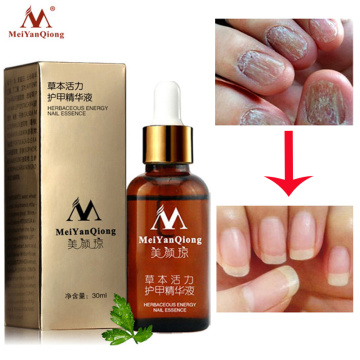 NEW!!!Fungal Nail Treatment Essence Nail and Foot Whitening Toe Nail Fungus Removal Feet Care Nail Gel Can Drop Shipping