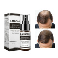 LANBENA Fast Powerful Hair Growth Products Hair Spray Essence Anti Hair Fall Treatment Laser Hair Regrowth For Women And Men