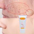 Exfoliating Gel Scrubs Peeling Dead Skin Removal Gel For Face And Body Skin Care Peeling Cleanser Exfoliating