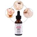 30ml Trichloroaectic Acid 20% Skin Peel Pore Minizing Wrinkles Spots Skin Care Face Serum