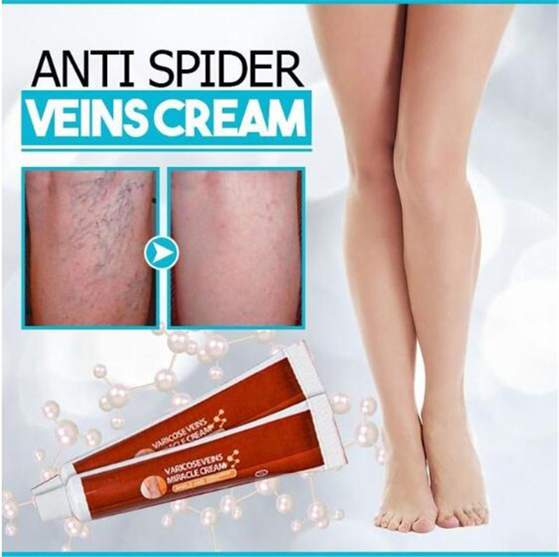 Anti-Spider Veins Cream Herbal Medicine for Varicose Veins Ointment Vasculitis Inflammation Leg Massage Varicose Veins Cream