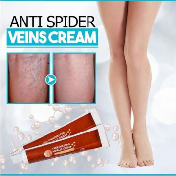 Anti-Spider Veins Cream Herbal Medicine for Varicose Veins Ointment Vasculitis Inflammation Leg Massage Varicose Veins Cream