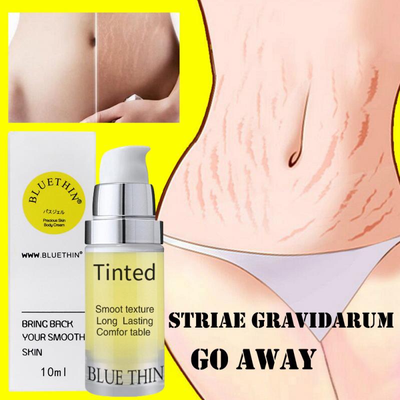 10ml Repair Cream Removal Fade Stretch Marks Scar Obesity Pattern Growth Pattern Gel Nourishing Maternity Body Skin Care TSLM1