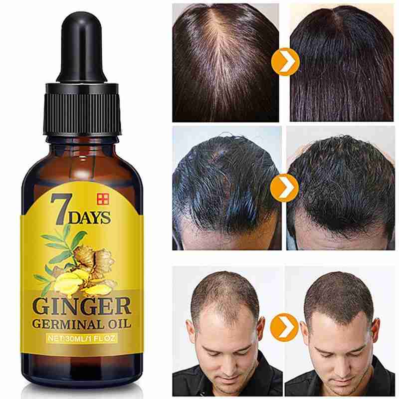 Ginger Hair Growth Liquid Anti Preventing Hair Loss Faster Serum Ginger Treatment Nourish Growing Oil Hair Repair