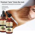 Fast Hair Growth Remedy Essence Oil Oriental Oils Hair Nutrition Hair Loss Treatment Solutions Product Hair Regrowth Product50ml