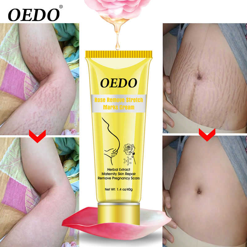 OEDO Scar Removal Cream Rose Remove Stretch Mark Cream Nourish Pregnant Women Skin Repair Remove Obesity Tattoo Body Care 40g