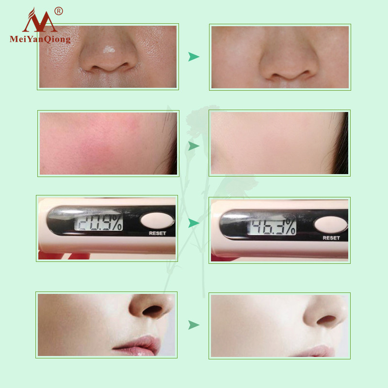 MeiYanQiong Shea Butter Collagen Moisturizing Face Toners Skin Care Moisturizing Whitening Acne Treatment Face Care Skin