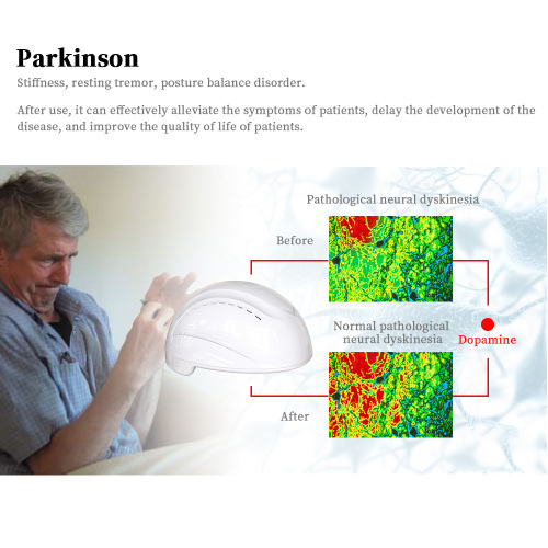 China photobiomodulation therapy helmet for Sale, China photobiomodulation therapy helmet wholesale From China