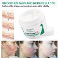 Scar Removal Cream Acne Wounds Cuts Mark Removal Ointment Cream Repairing Scars Moisturizing Promote Skin Renewal Skin Care Tool