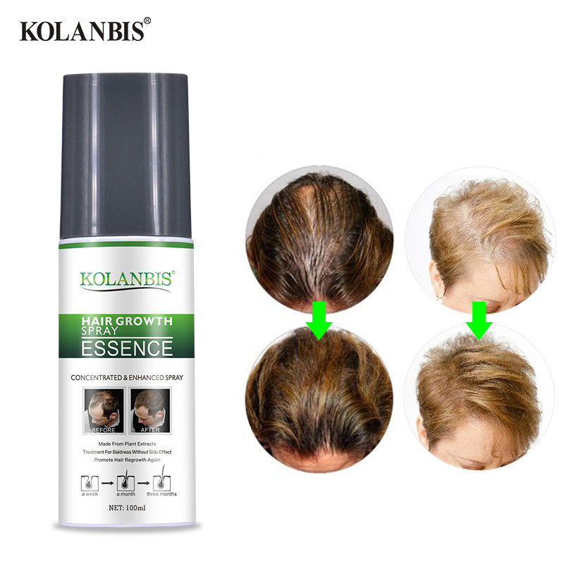 3 Bottles Thick Fast Growing Oily Permanent Hair Growth Serum Hair Loss Products Bald Restore Fuller Treatment Alopecia Regrowth