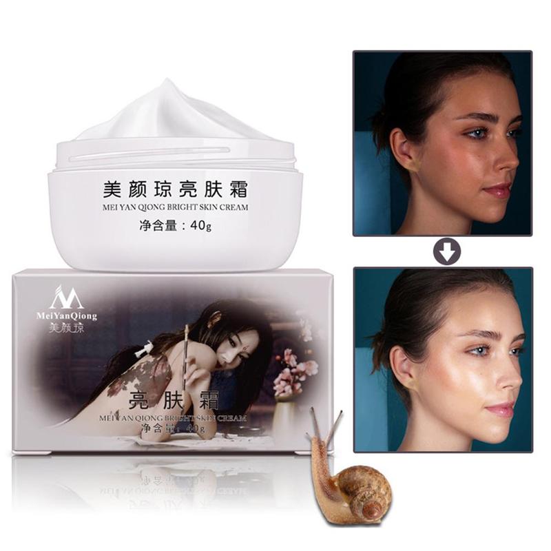 Powerful Brightening Skin Freckle Cream Remove Melasma Acne Spots Pigment Melanin Moisturizing Face Care Strong Effects 40g Hot