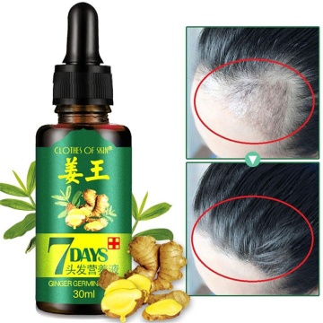 30ML Hair Growth Ointment 7 Day Ginger Germinal Serum Essence Oil Loss Treatement Growth Hair Hair Care Nutrient Solution